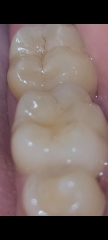 Any dentists on here....(pics)