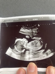 20 week gender guess 