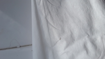 Scratched this thing out of my shoulder 