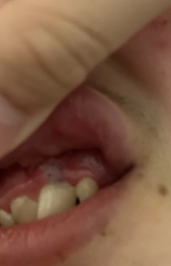 Any dentists or medics on? 