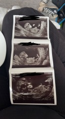 Nub theory/gender guesses