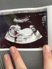 20 week gender guess 