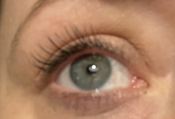 I'm 40 and I don't know what colour my eyes are! Photos