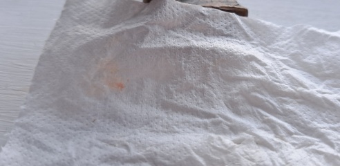 Is this period or implantation spotting?