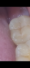 Any dentists on here....(pics)