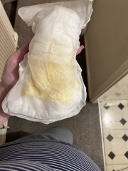 Waters breaking at 31 weeks TRIGGER WARNING PICTURE IN CHAT 