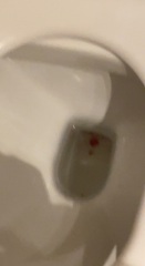 BLOODY SHOW? Picture TW