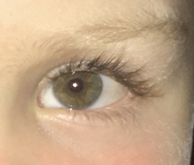 Eye Colour disagreement 