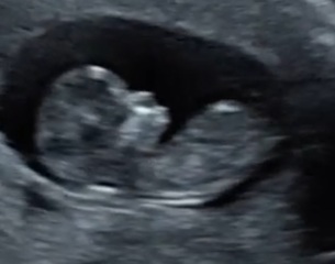 Any nub theory guesses?