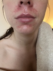 Can anyone tell me why my skin is doing this?