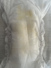 Waters breaking at 31 weeks TRIGGER WARNING PICTURE IN CHAT 