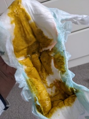 EBF 5mo VERY mucousy nappies [WARNING: pics]