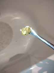 Ears successfully cleared of huge blockage!