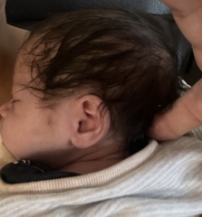 Head shape 
