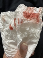 Very early pregnancy and so much anxiety after miscarriage