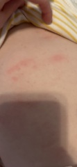 Does ds need to see a doctor re rash reappearing constantly