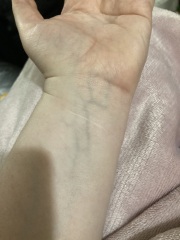 Something weird happened to my wrist today