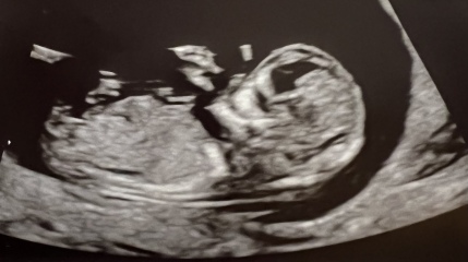 End Aug/Early Sept Due Date (Thread 2)