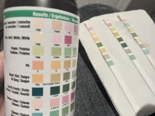 Any midwives/HCP around? (Pic) Protein ++++ on old, dry urine dipstick