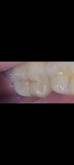 Any dentists on here....(pics)