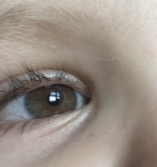 Eye Colour disagreement 