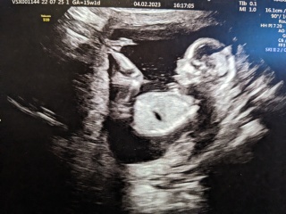 Due July 2023 thread 2