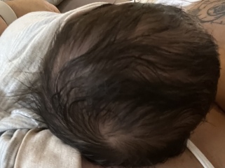 Head shape 