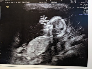 Due July 2023 thread 2