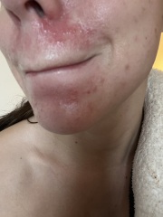 Can anyone tell me why my skin is doing this?