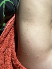 Please have a look at this rash