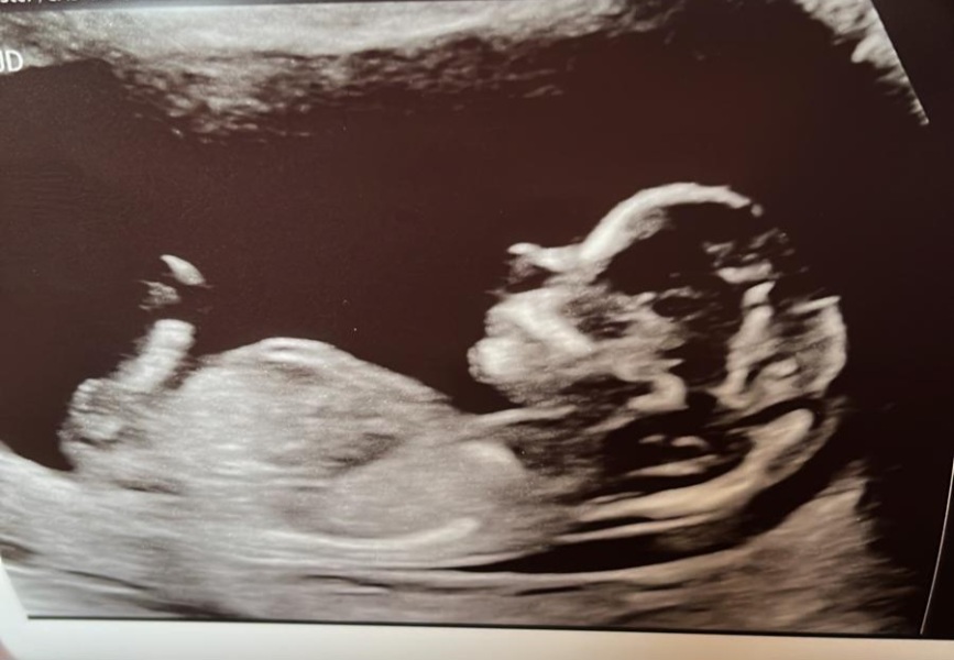 Second trimester and beyond! - Sept 23 