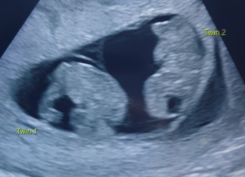 Due October 2023 - thread 3