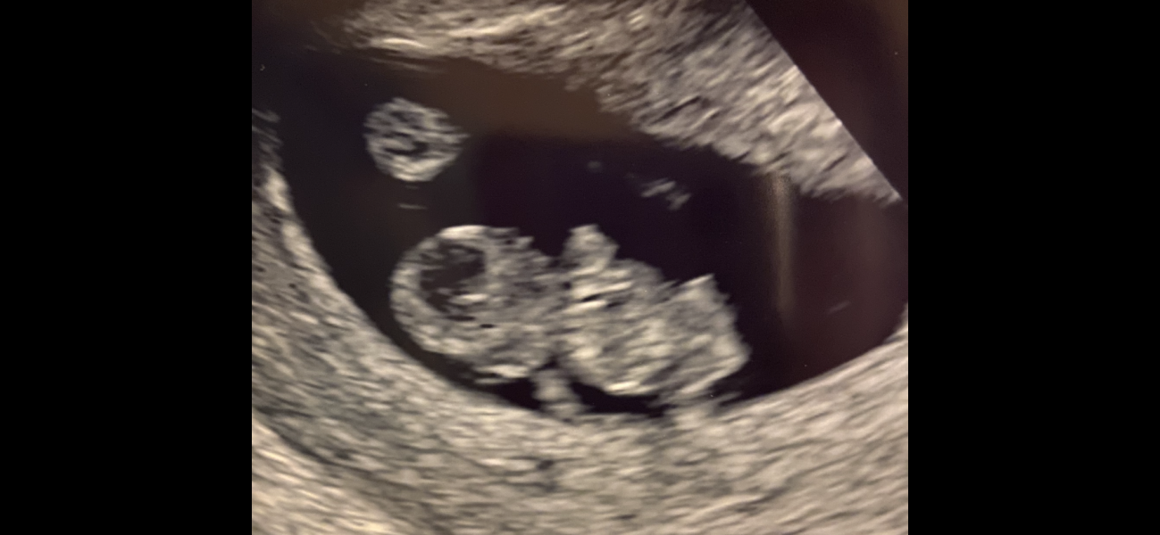Due October 2023 - thread 3