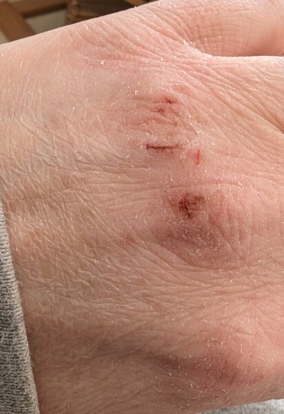 Help my hands! (Please - pic included)