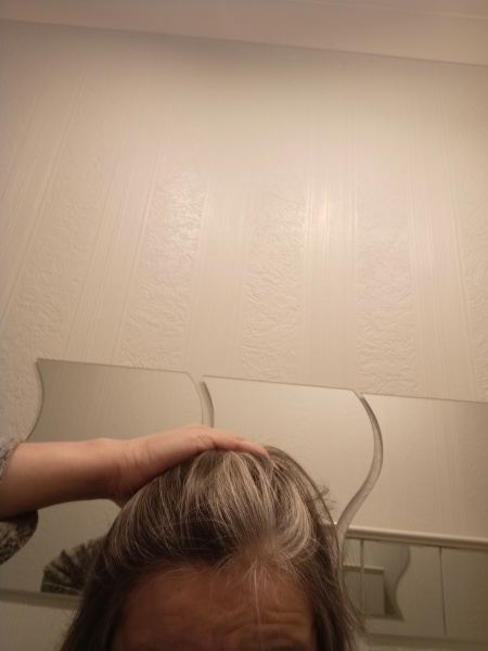 If you have thinning hair how are you managing?