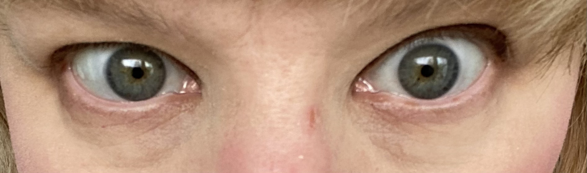 I'm 40 and I don't know what colour my eyes are! Photos