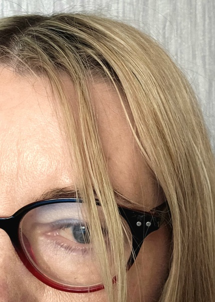 Hair is greasy and lank, even after washing it. 