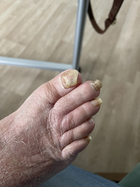 Care home neglect?