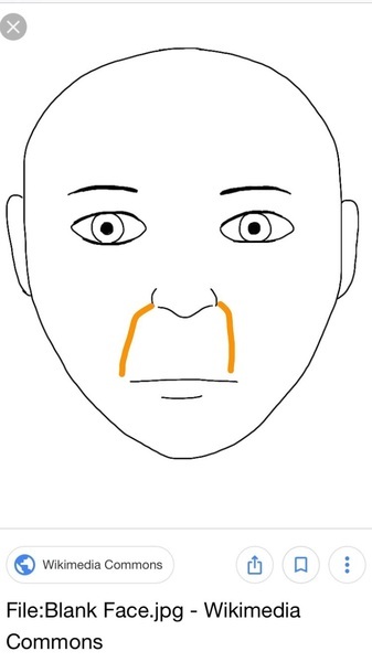 I have these weird orange lines where my smile lines are and can’t find the answer why?