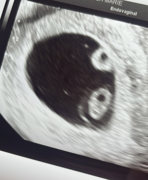 Due October 2023 - thread 3