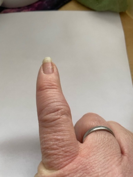 Finger