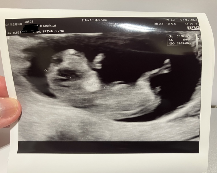 Due September 2023 after miscarriage 🌈