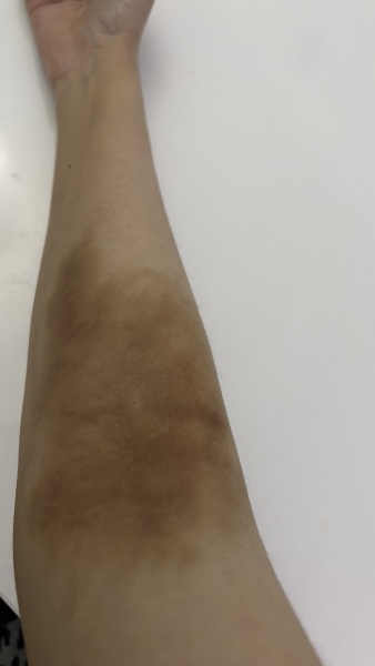 Please help me find an awful tattoo