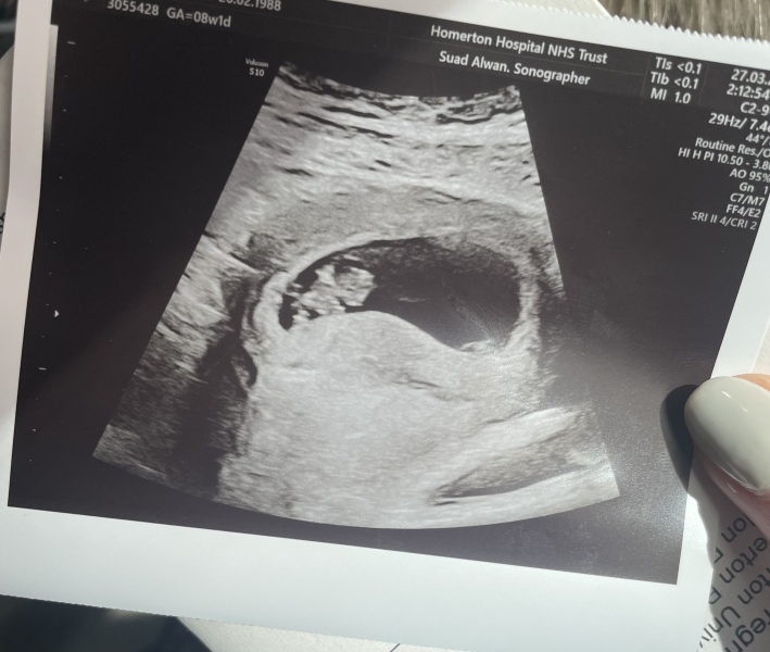 Due November 2023 - part 2