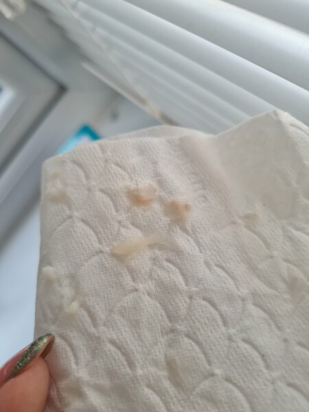 Some of my mucus plug it looks like? *Warning* Photos