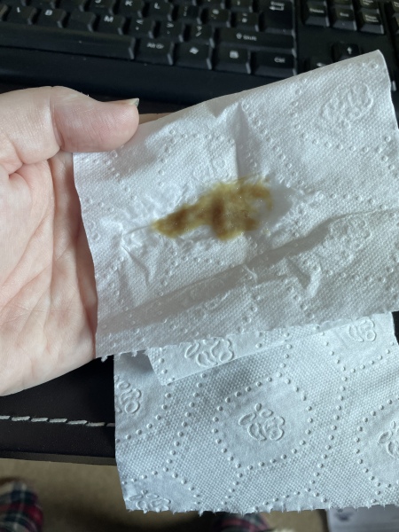 The best thing your body has produced *warning-grim content not suitable for weak-stomached persons*