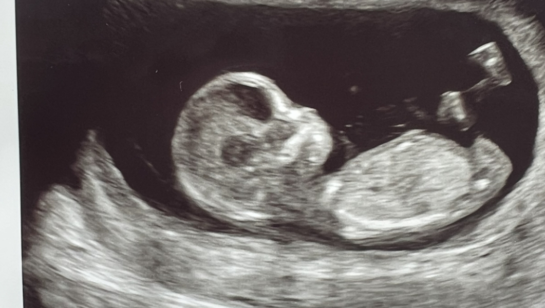 Boy or girl 