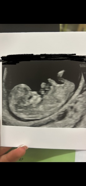 Any gender guesses 🙊