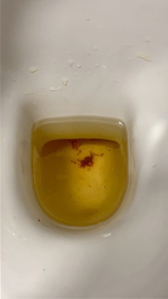 Warning contains images- Does anyone have an idea as to why this may be happening?
