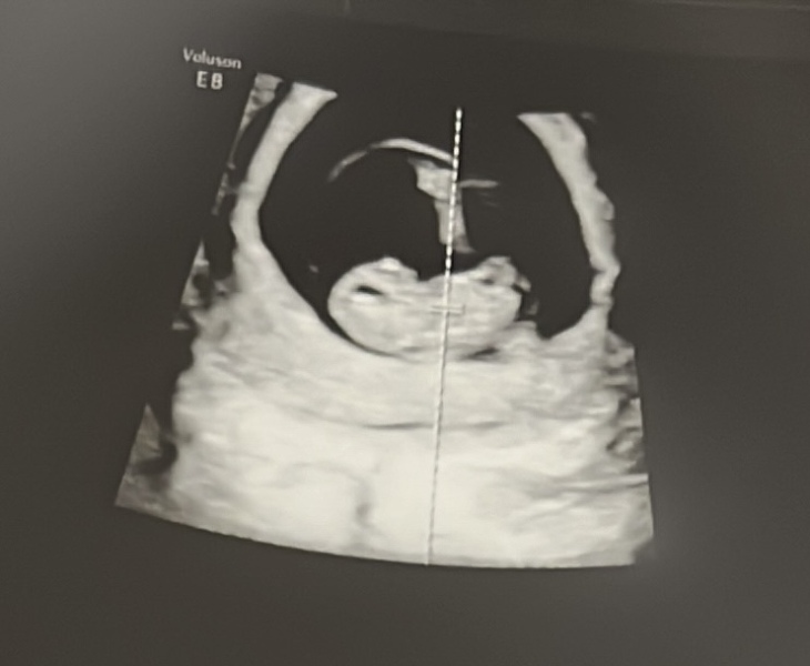 Due October 2023 - thread 3